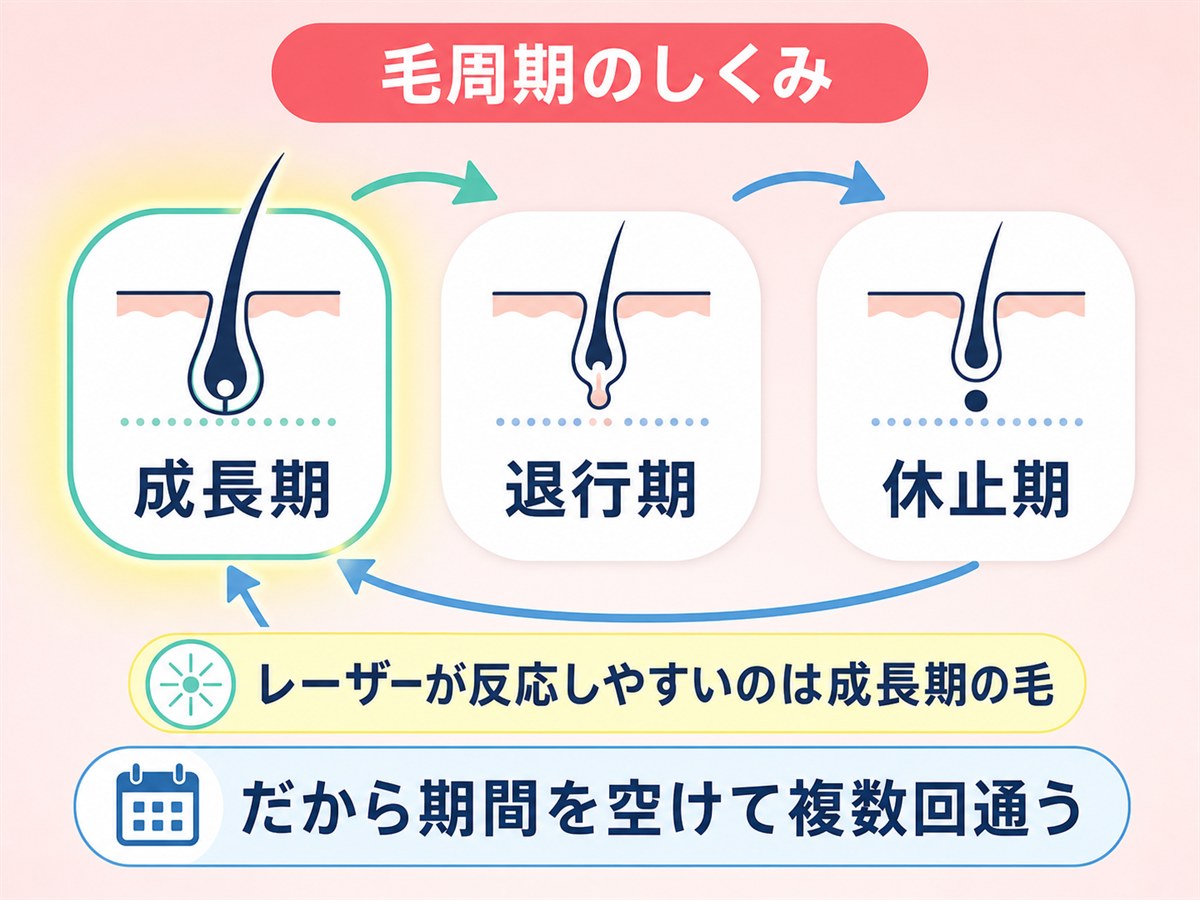 毛周期（成長期・退行期・休止期）と医療脱毛の関係を示す図解
