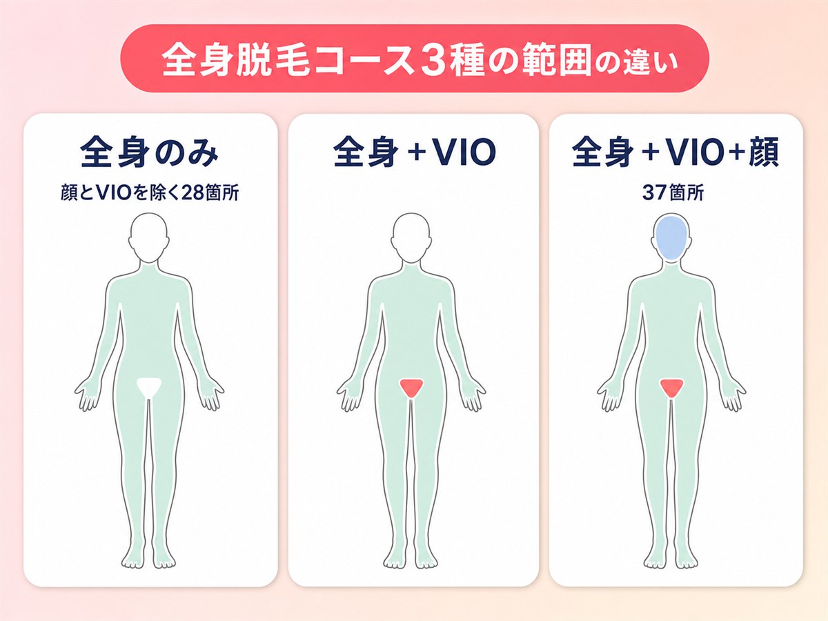 レジーナクリニックの全身脱毛コース3種の部位範囲の違いを示す図解