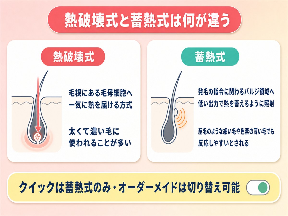 TCB脱毛の熱破壊式と蓄熱式の違い